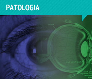 patologias oculares clínica gamédica - Alfredo Brandão - Guarulhos